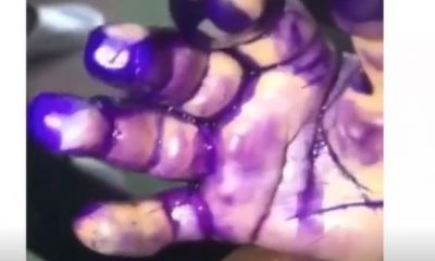 Lady scalds her 2-months-old son’s hand with hot water over a misunderstanding with her baby-daddy