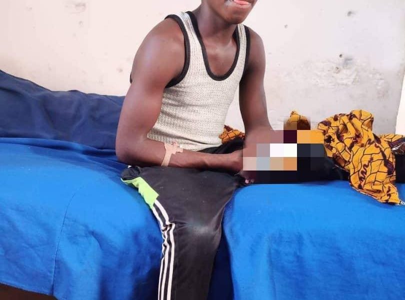 19-year old recounts how bandits cut off his arm after N1m ransom