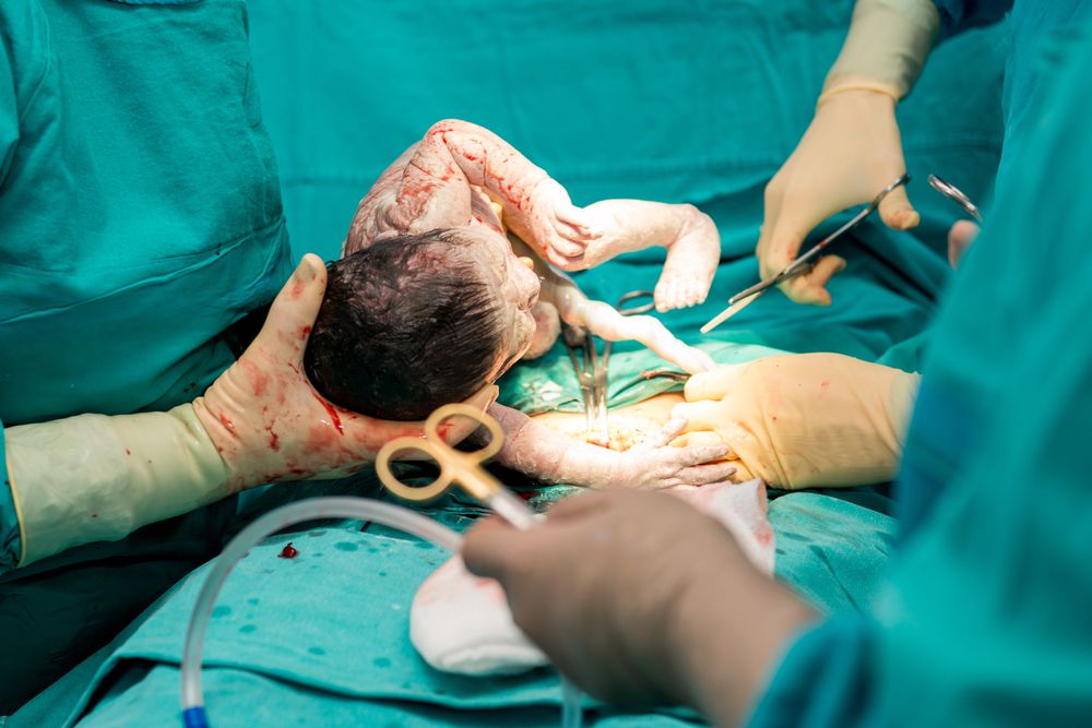 Vaginal delivery after two caesarean may cause death– Gynaecologists