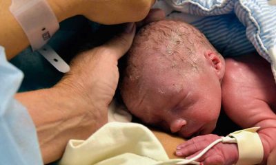 UK’s first womb transplant raises fertility hope for women
