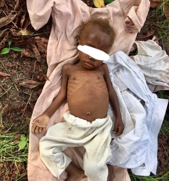 Aid worker rescues abandoned toddler accused of witchcraft 
