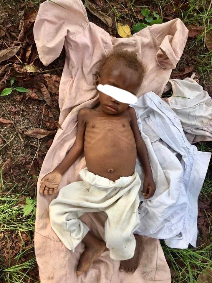 Aid worker rescues abandoned toddler accused of witchcraft 