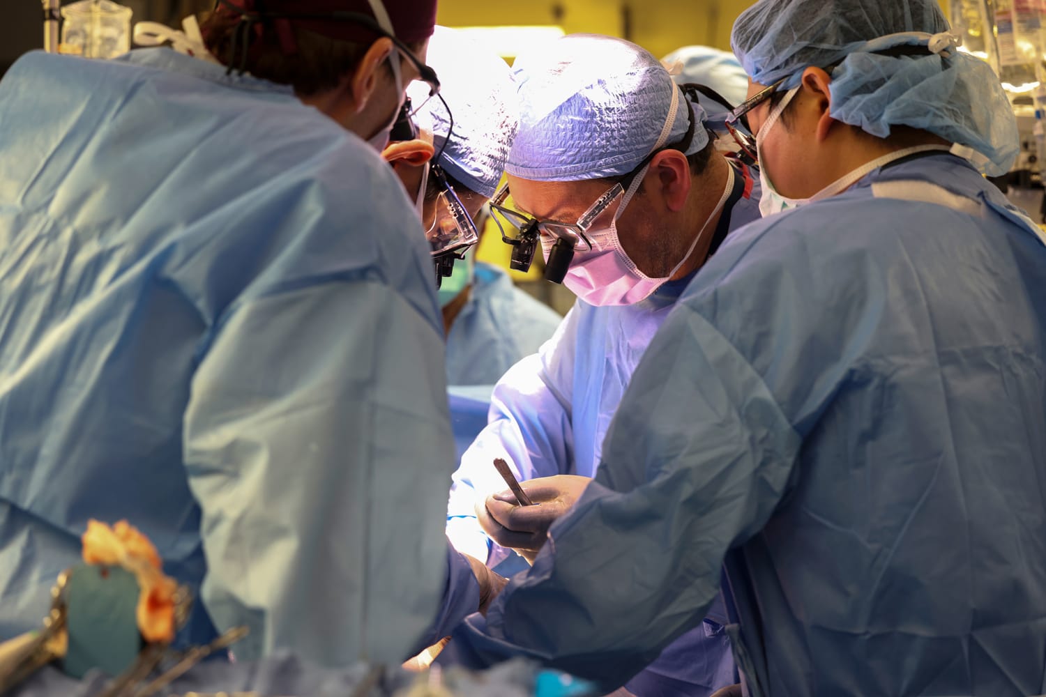 US Surgeons perform first pig to human kidney transplant