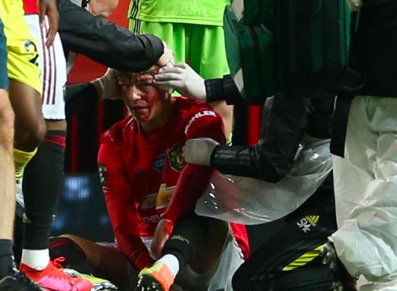 Manchester United suffer double injury ahead of Chelsea FC clash