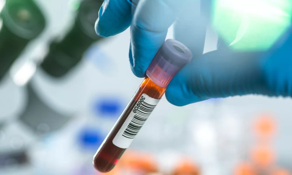 Scientists in the UK say they have found proteins in the blood that could warn people of cancer more than seven years before it is diagnosed.