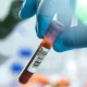 Scientists in the UK say they have found proteins in the blood that could warn people of cancer more than seven years before it is diagnosed.