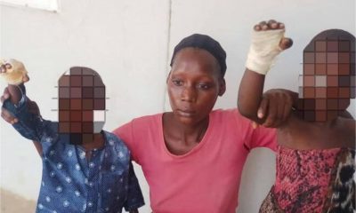 23-year-old woman arrested for inflicting severe burns on her step-children