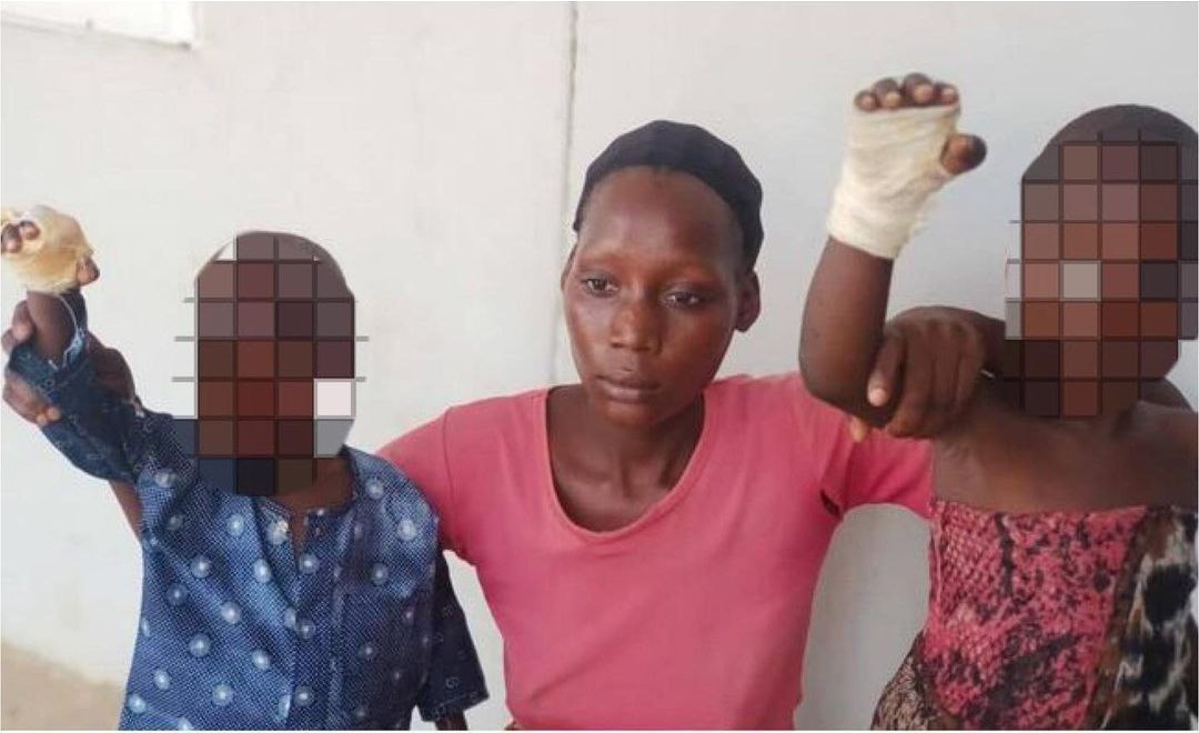 23-year-old woman arrested for inflicting severe burns on her step-children