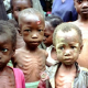 High number of undernourished children worrisome - FG
