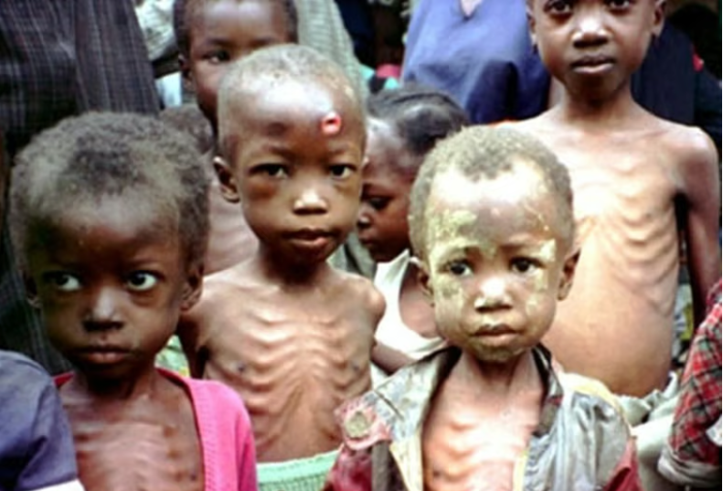 High number of undernourished children worrisome - FG