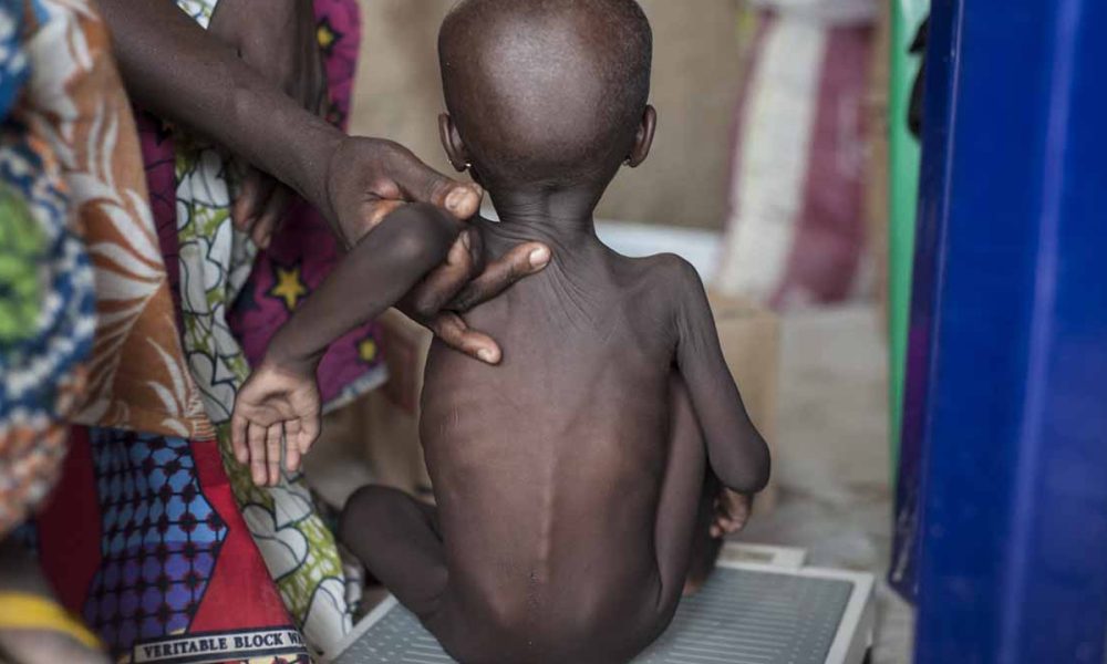 Urgent action needed to save millions of children from malnutrition in North-east says UN official