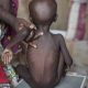 Urgent action needed to save millions of children from malnutrition in North-east says UN official