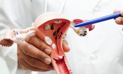 Cervical cancer is preventable and curable with early action - UN