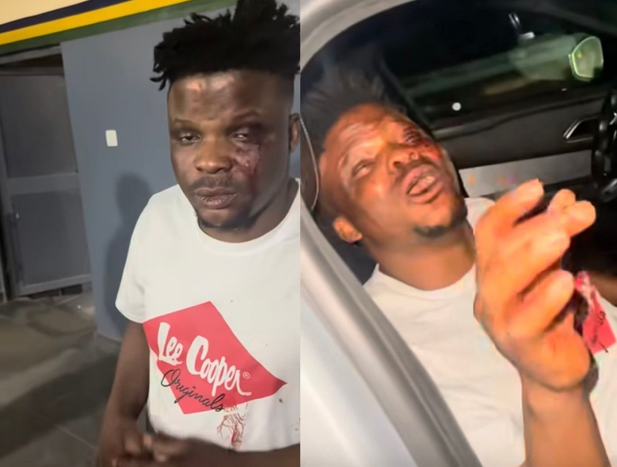 Lagos Police detain officers over alleged assault on actor Ijoba Lande