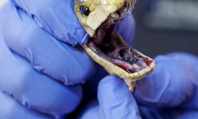 Singer’s death sparks doctor’s takedown of snakebite myths, exposes public health gaps