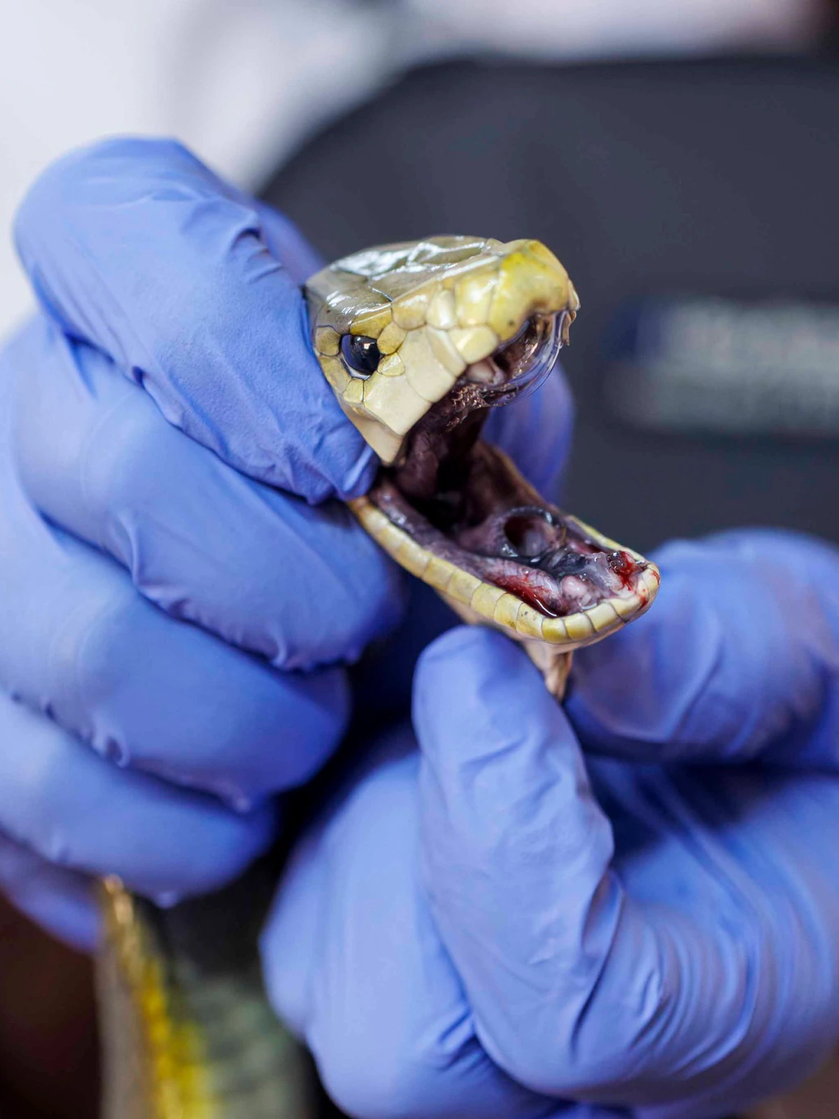 Singer’s death sparks doctor’s takedown of snakebite myths, exposes public health gaps