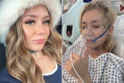Teen vaping habit ends in cancer diagnosis for 22-year-old woman