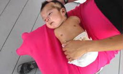 Research raises alarm over pesticides tied to birth defects, premature births