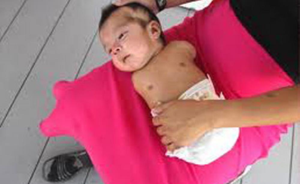 Research raises alarm over pesticides tied to birth defects, premature births