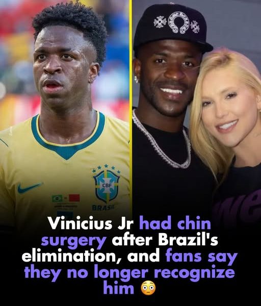Vinícius Jr.'s new look sparks online debate after cosmetic procedure