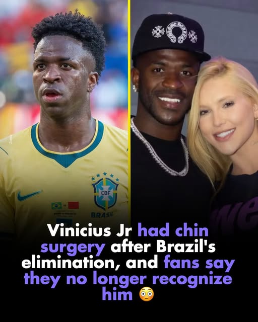 Vinícius Jr.'s new look sparks online debate after cosmetic procedure